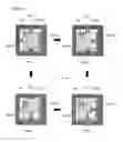 Fig. 10 - IMAGE SENSOR AND IMAGE CAPTURE DEVICE