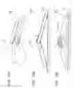 Fig. 13 - Image capturing device