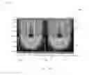 Fig. 08 - Liquid-crystal panel and liquid-crystal display device