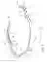 Fig. 03 - Eyeglass temple having an auxiliary cushion frame