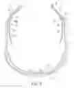 Fig. 04 - Eyeglass temple having an auxiliary cushion frame