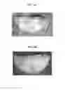 Fig. 05 - Apparatus for imaging a tissue region