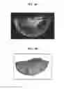Fig. 06 - Apparatus for imaging a tissue region
