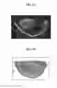 Fig. 07 - Apparatus for imaging a tissue region