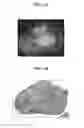 Fig. 08 - Apparatus for imaging a tissue region
