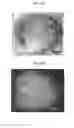 Fig. 10 - Apparatus for imaging a tissue region