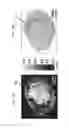 Fig. 12 - Apparatus for imaging a tissue region