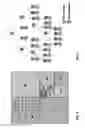 Fig. 05 - Video filtering using a combination of one-dimensional switched filter and one-dimensional adaptive filter