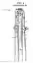Fig. 02 - Method and apparatus for a jet pump three point slip joint clamp
