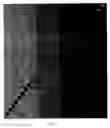 Fig. 06 - Scanning device and method for back-scatter imaging with a radiation beam