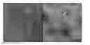 Fig. 01 - Automated detection of melanoma