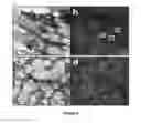 Fig. 05 - Automated detection of melanoma