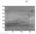 Fig. 01 - METHOD FOR DETECTING STREAK NOISES IN DIGITAL IMAGE