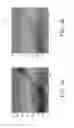 Fig. 04 - METHOD FOR DETECTING STREAK NOISES IN DIGITAL IMAGE