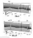 Fig. 06 - Artifact management in rotational imaging