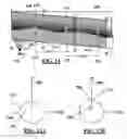Fig. 07 - Artifact management in rotational imaging