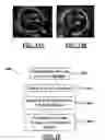 Fig. 08 - Artifact management in rotational imaging