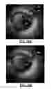 Fig. 09 - Artifact management in rotational imaging