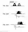Fig. 41 - Optical transmitter, optical transmission method, and wavelength-selective variable delayer