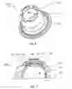 Fig. 03 - Ball joint