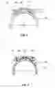Fig. 04 - Ball joint