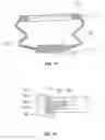 Fig. 12 - Ball joint