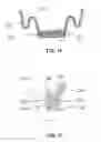 Fig. 13 - Ball joint