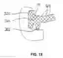 Fig. 14 - Ball joint