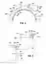 Fig. 05 - Removable upper steam guide segment for steam turbine