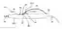 Fig. 01 - SUCTION DEVICE