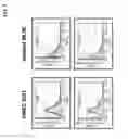 Fig. 06 - METHOD FOR TREATING PANCREATITIS WITH MESENCHYMAL STEM CELLS