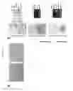 Fig. 20 - METHOD FOR TREATING PANCREATITIS WITH MESENCHYMAL STEM CELLS