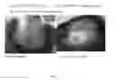 Fig. 06 - METHODS AND COMPOSITIONS FOR THE TREATMENT, PREVENTION, AND ALLEVIATION OF BONE AND CARTILAGE DISEASES OR INJURIES AND HAIR LOSS
