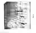 Fig. 09 - Debriding composition from bromelain and methods of production thereof