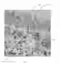 Fig. 04 - METHODS FOR DIAGNOSING CHRONIC DIARRHEA THROUGH PROTEIN SECRETION ANALYSIS