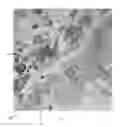 Fig. 05 - METHODS FOR DIAGNOSING CHRONIC DIARRHEA THROUGH PROTEIN SECRETION ANALYSIS
