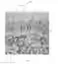 Fig. 06 - METHODS FOR DIAGNOSING CHRONIC DIARRHEA THROUGH PROTEIN SECRETION ANALYSIS
