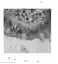 Fig. 07 - METHODS FOR DIAGNOSING CHRONIC DIARRHEA THROUGH PROTEIN SECRETION ANALYSIS