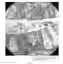Fig. 08 - METHODS FOR DIAGNOSING CHRONIC DIARRHEA THROUGH PROTEIN SECRETION ANALYSIS