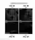 Fig. 09 - Activin receptor-like kinase-1 compositions and methods of use