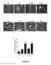 Fig. 03 - Methods of stimulating liver regeneration
