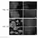 Fig. 03 - METHOD OF TREATING TUMORS