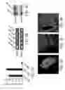 Fig. 07 - METHOD OF TREATING TUMORS