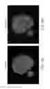 Fig. 08 - METHOD OF TREATING TUMORS