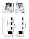 Fig. 09 - Further use of protein kinase N beta