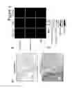 Fig. 04 - Diagnostic Method for Predicting the Risk of Cancer Recurrence Based on Histone Macroh2A Isoforms