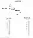 Fig. 152 - IMMUNIZATION AGAINST CHLAMYDIA PNEUMONIAE