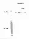Fig. 74 - IMMUNIZATION AGAINST CHLAMYDIA PNEUMONIAE