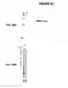 Fig. 93 - IMMUNIZATION AGAINST CHLAMYDIA PNEUMONIAE