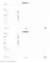 Fig. 04 - ANALYSIS OF SACCHARIDE VACCINES WITHOUT INTERFERENCE